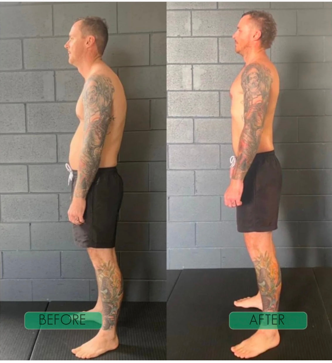 Silverback™️ Shoulder Lift Support