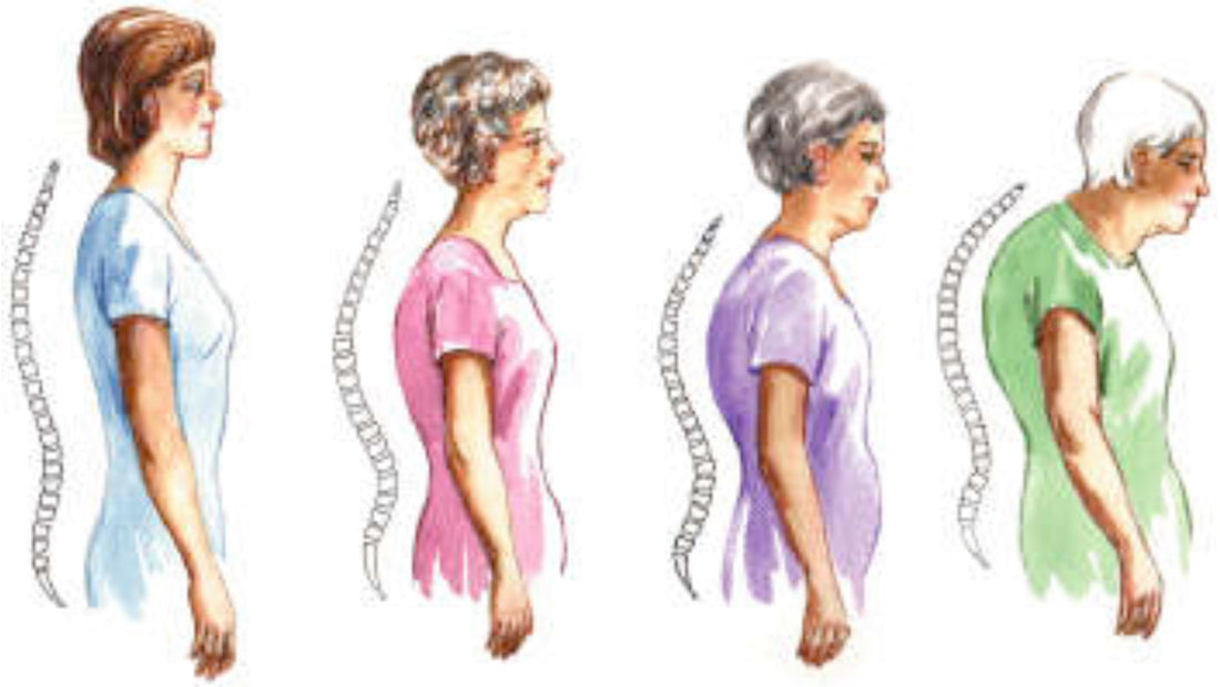 Why “Just Sit Up Straight” Stops Working After 60